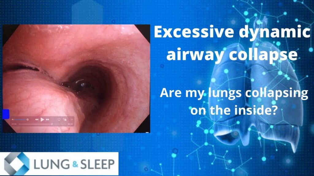 1124 Excessive Dynamic Airway Collapse An Introduction Youtube