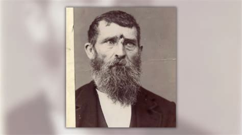 American Civil War Veteran Jacob Miller Survived Being Shot In The Forehead This Is Him In