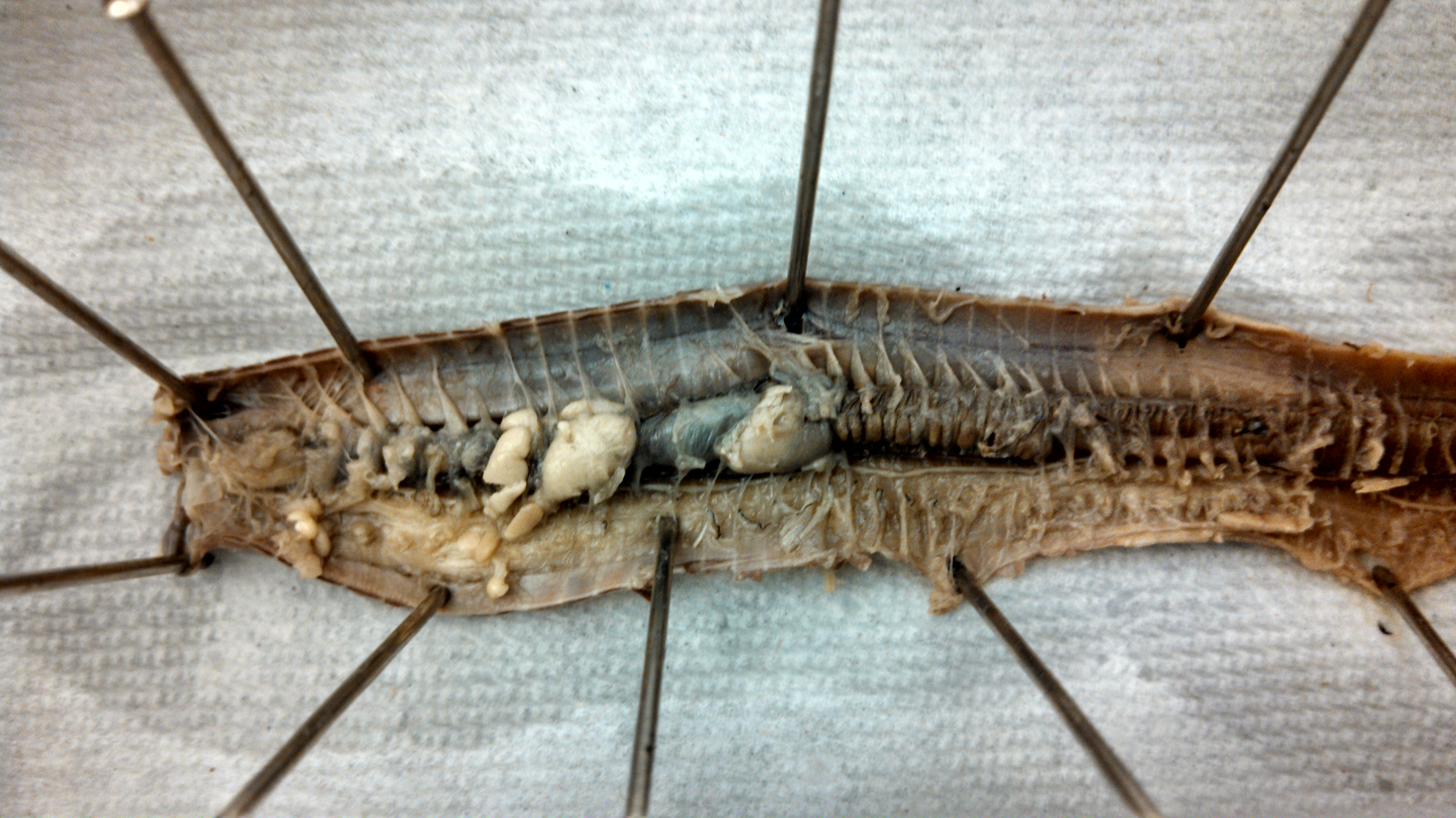 Earthworm Dissection Lab Worksheets Procedures Diagrams Video