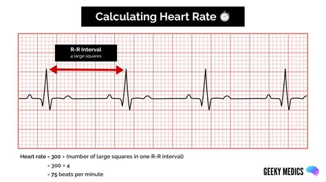 Ekg Heart Rate