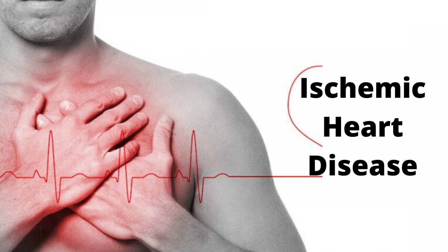 Ischemic Heart Disease E Chart Quick Reference Guide English Edition