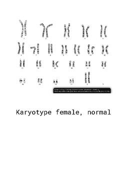 Karyotype Matching Activity Biology 30 By Sciencetastic Tpt