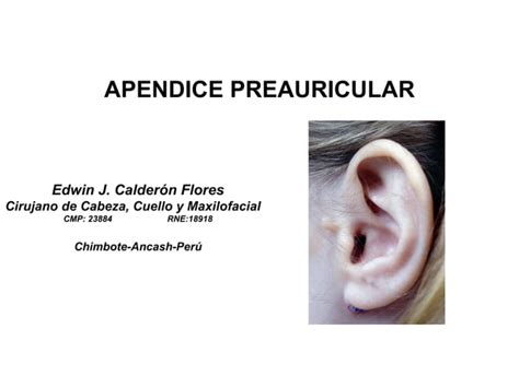 Pdf Apendice Preauricular Caso Clinico Y Breve Revision De La Literatura Dokumen Tips