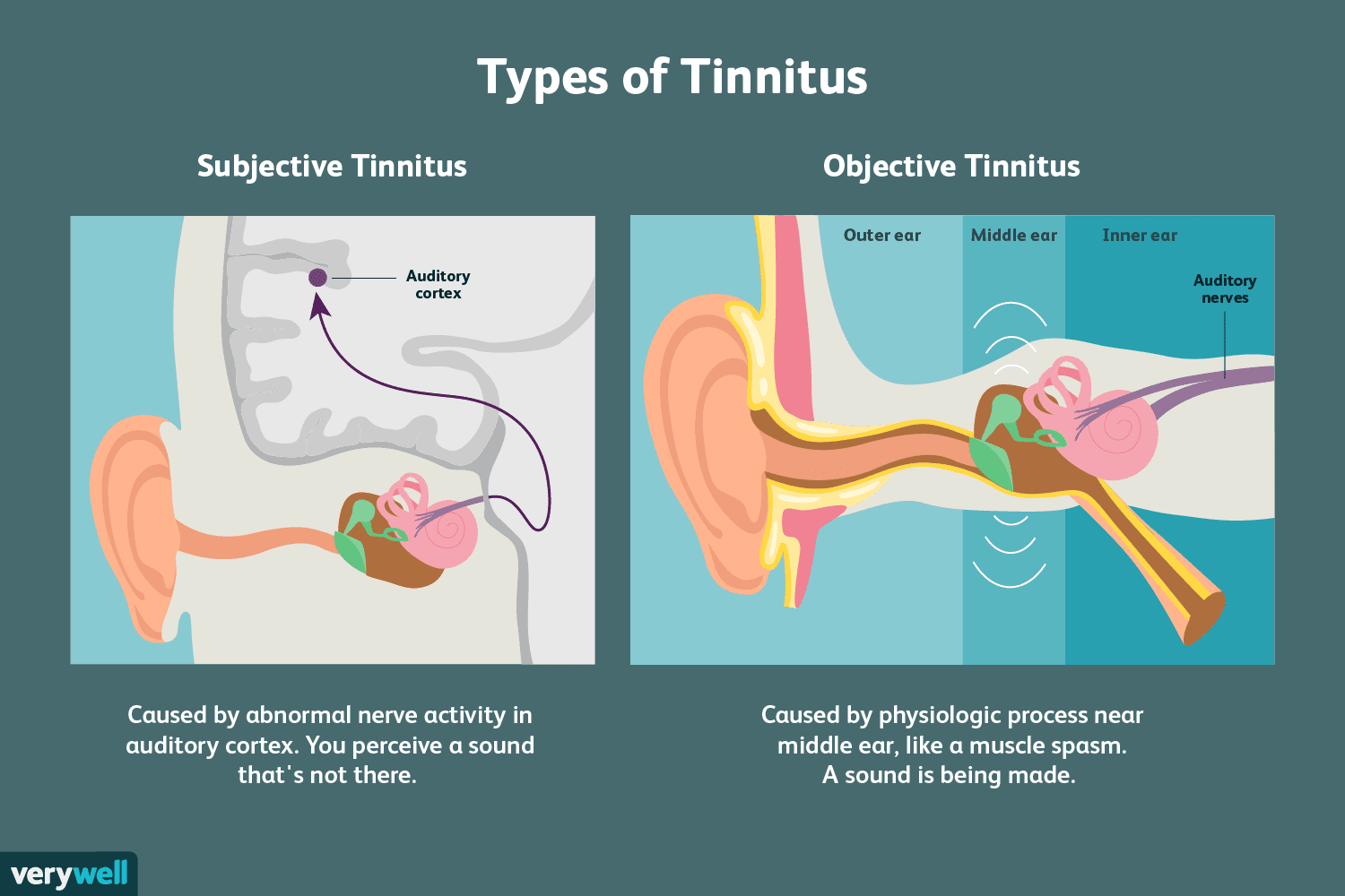 Resolve Your Tinnitus And 5 Other Health Issues With The Sj5 Acupressure Point Selfcare