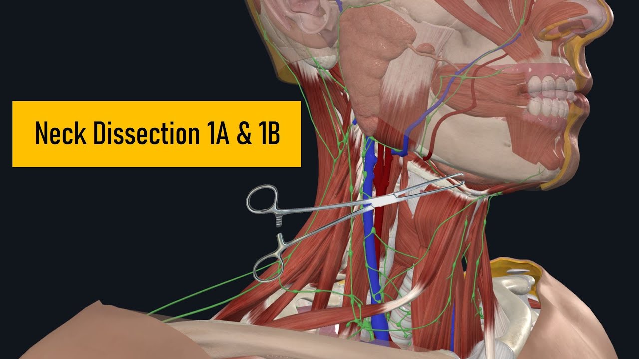 Surgery Levels 1A Amp 1B Neck Dissection Essential Techniques For Beginners 401 1 Parts