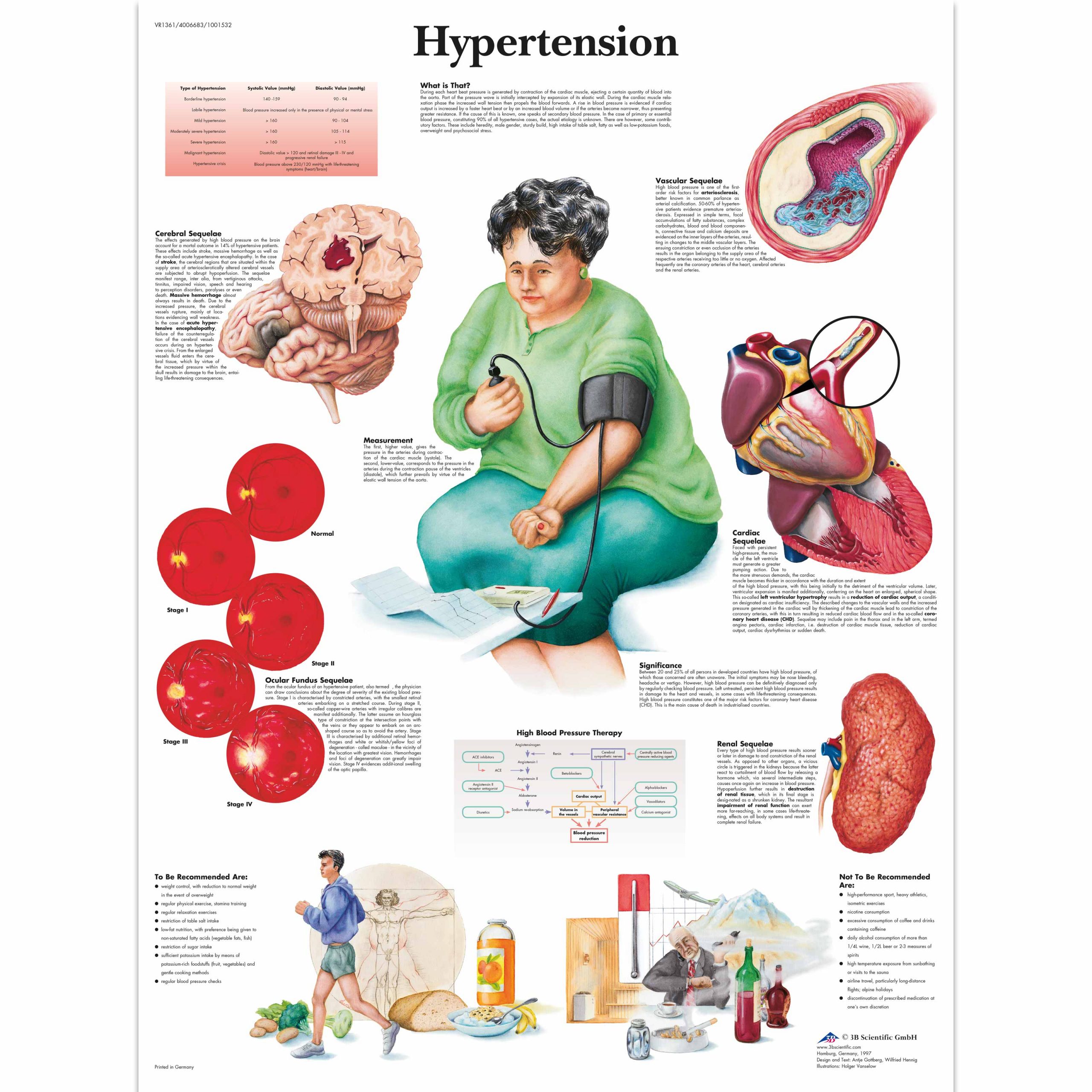 Understanding Hypertension Infographic Rehabilitate Your Heart